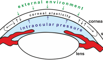 Non-Contact Tonometers