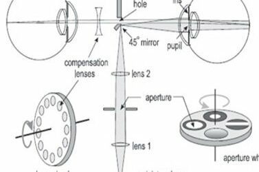 Ophthalmoscope Optical Layout